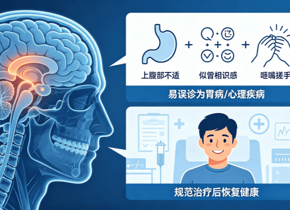 　颞叶癫痫：最常见的局灶性癫痫